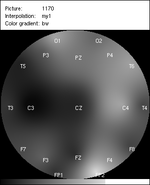 interpolation_output_my1_bw